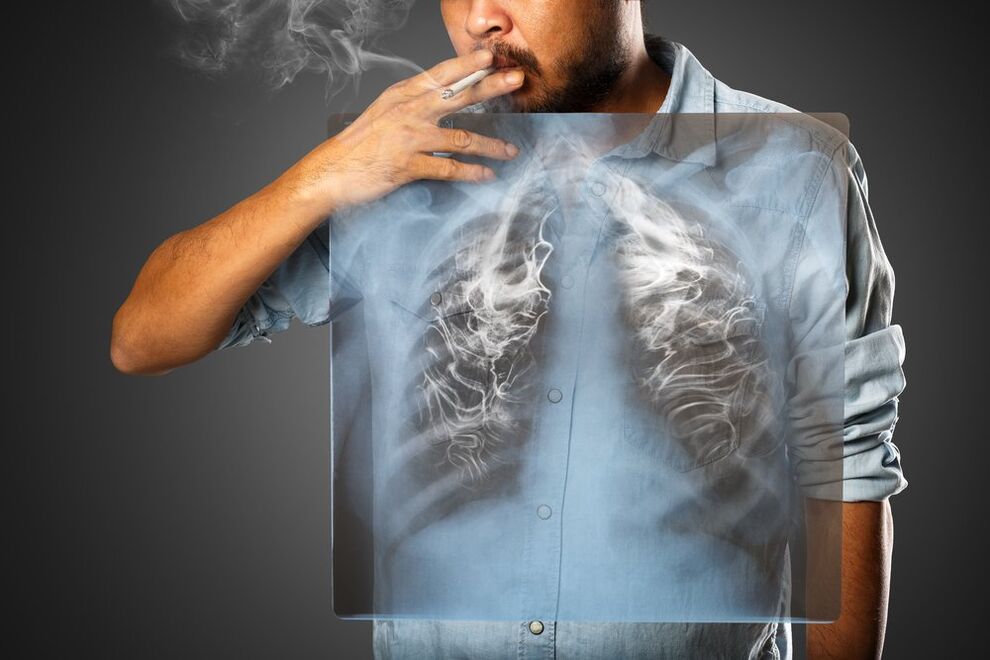 rūkymas daro žalingą poveikį žmogaus organizmui
